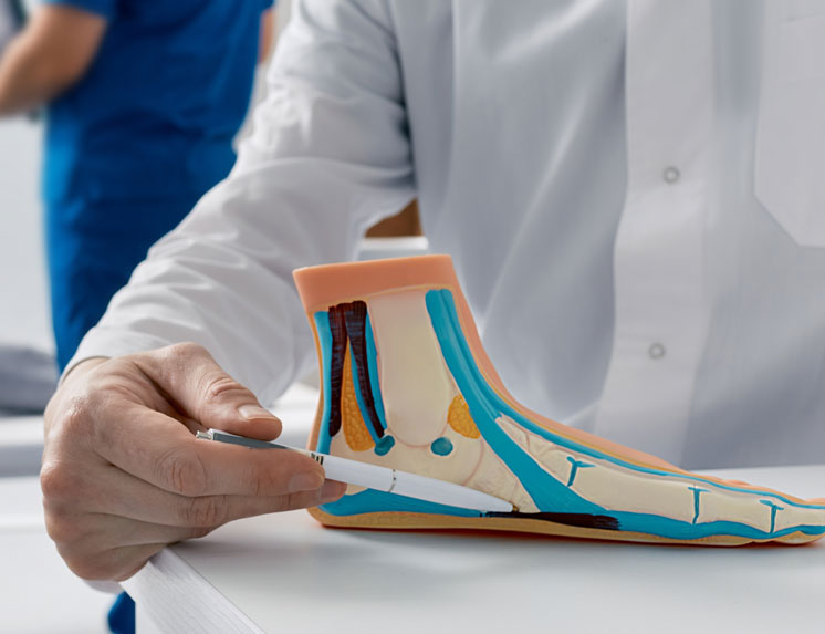 A doctor in a lab coat uses a pen to point to the arch on a cross-section anatomical model of a human foot, illustrating a condition such as flat feet.